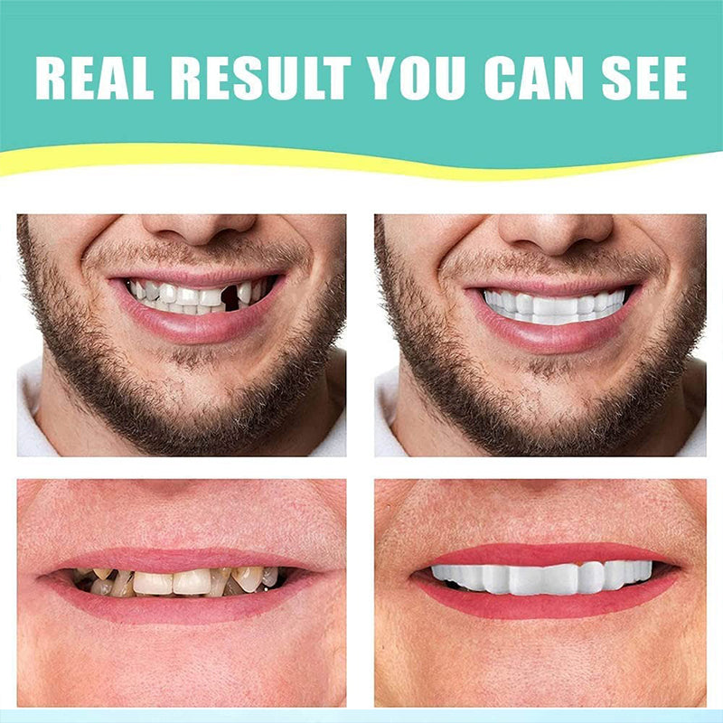 Dentures Veneers Tooth（3Pcs）